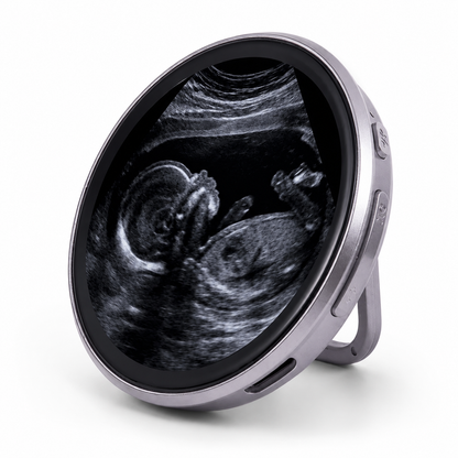 EverFrame™ -El primer recuerdo de tu bebe